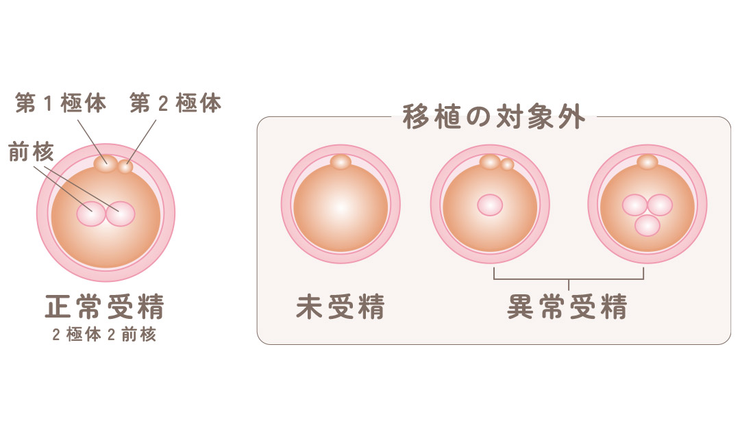 受精判定